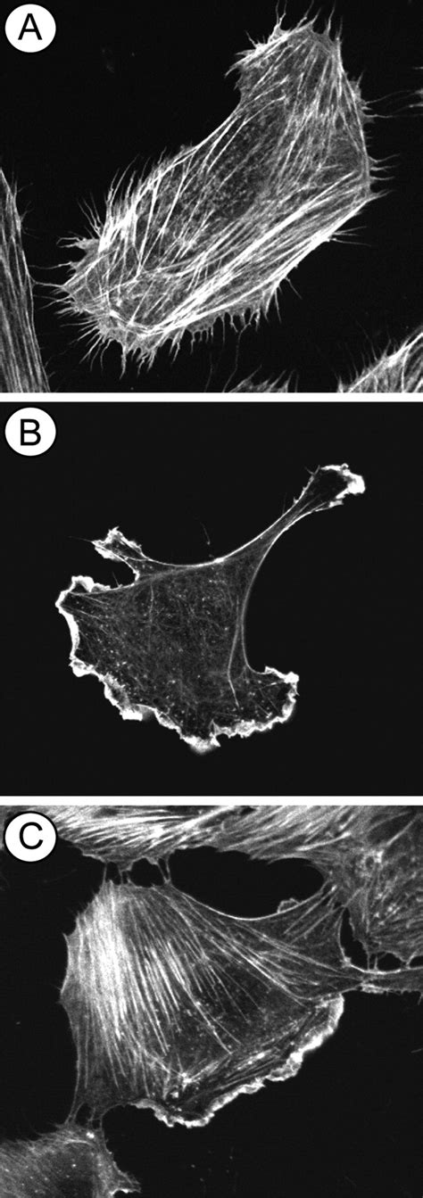 Endothelial Cell Migration During Angiogenesis | Circulation Research