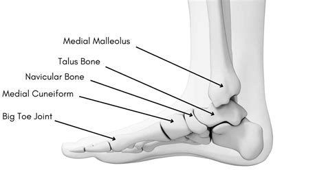 Medial Malleolus Pain: Get the answers from a Foot Specialist