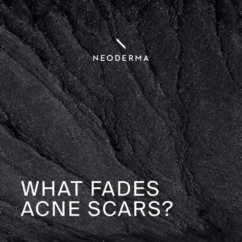 What Fades Acne Scars? – NEODERMA