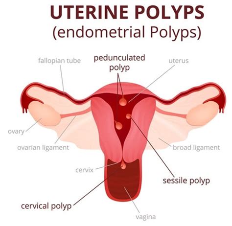 Can A Uterus Grow Back? Exploring The Regenerative Potential