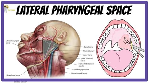 Parapharyngeal Space Abscess