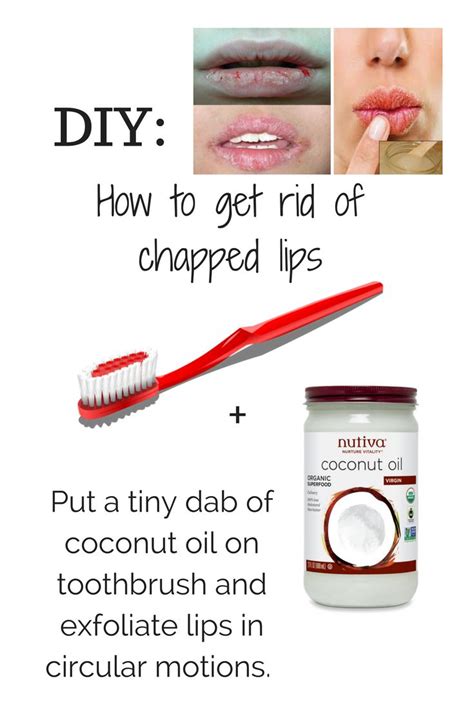 DIY how to get rid of dry, cracked, chapped lips fast | Dry lips remedy, Dry skin care, Dry skin ...