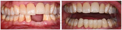 Smile Gallery - Dr. Christopher Naranjo