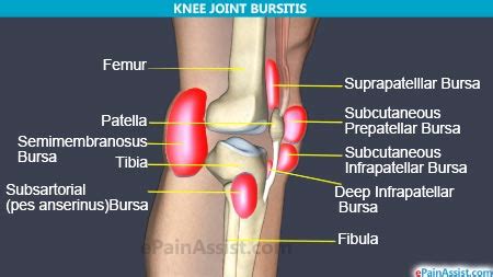 5 Major Causes of Knee Joint Pain|Inflammation, Infection, Injury ...