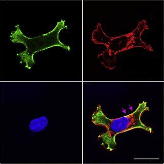 A Lipid Raft Membrane Microdomain. | Download Scientific Diagram