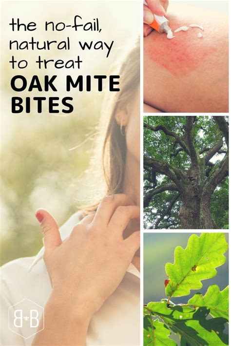 56 Best of How To Treat Mites Bites On Humans - insectza