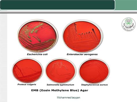 Enterobacter aerogenes antibiotic treatment