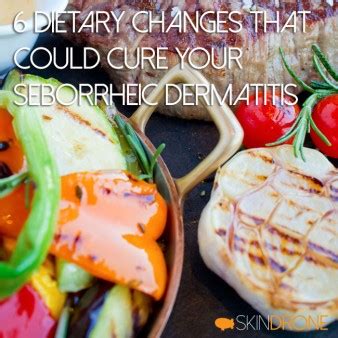 9 Diet Changes That Could Cure Your Seborrheic Dermatitis – SkinDrone