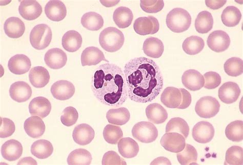 neutrophil, neutrophile | Taber's Medical Dictionary