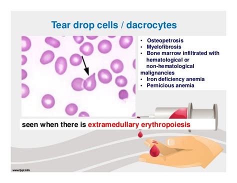 Blood film examination