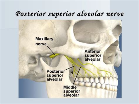 Posterior superior alveolar (psa) nerve block