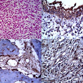 ( A ) An increased number of gram-negative cells ( pink-red ). ( B )... | Download Scientific ...