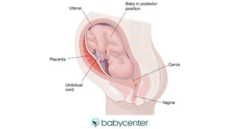 Occiput posterior position in labor | BabyCenter