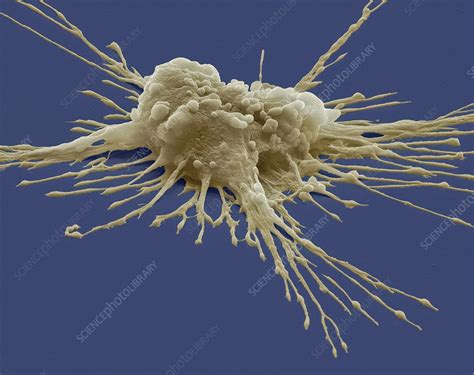 Pluripotent stem cell, SEM - Stock Image - F004/0839 - Science Photo Library