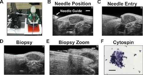 Cervical lymph node biopsy set-up, imaging and cytospin analysis of ...