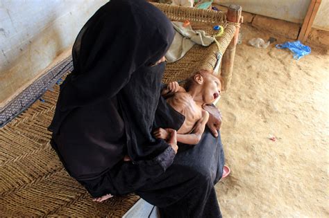 Famine Stalks Yemen, as War Drags On and Foreign Aid Wanes - The New ...