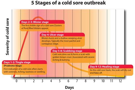 Cold-Sore progression - A graphic representation | Canker sore, Cold sore, Cold sores remedies