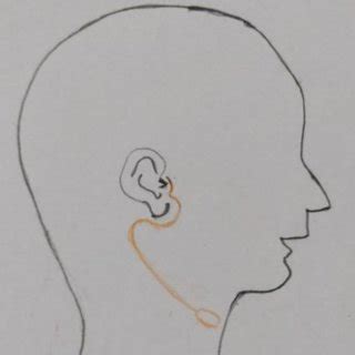 Incision with lower elliptical extension around the opening in lower... | Download Scientific ...