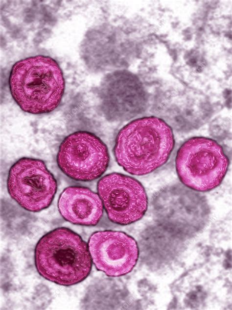 Cytomegalovirus - Stock Image - C017/1727 - Science Photo Library