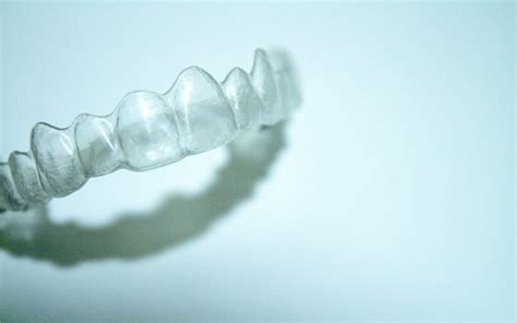 Read about the invisalign pros and cons | usiw.org