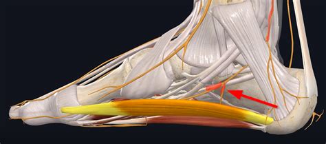 Baxter's Neuropathy: Causes, Symptoms, Treatment - CSC