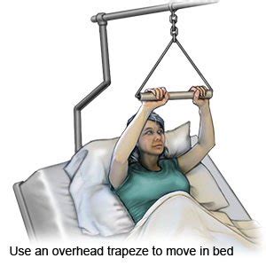 How to Use an Overhead Trapeze - What You Need to Know