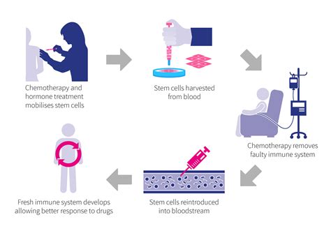 Stem cell transplants to be used in treating Crohn's disease