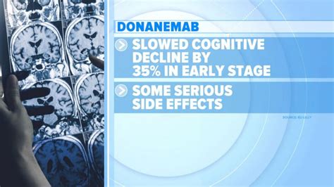 Video Alzheimer's drug donanemab slows cognitive decline in clinical ...