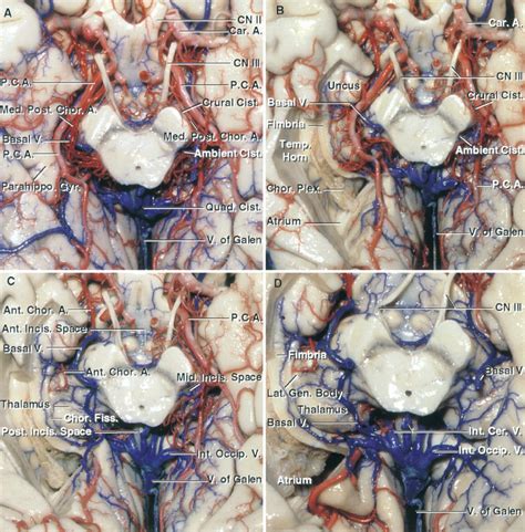 Tentorial Incisura | Neuroanatomy | The Neurosurgical Atlas