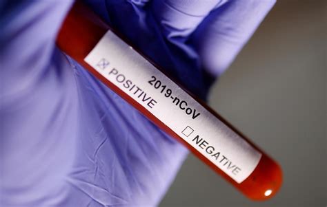 Labcorp Launches New Neutralizing Antibody Test For COVID-19 | Faculty ...