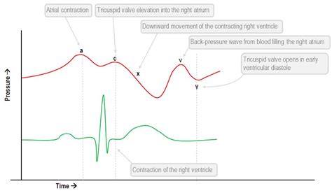 Interpretation of the central venous pressure waveform | Deranged ...