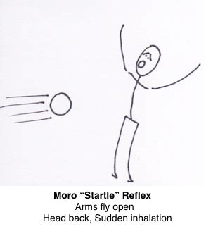 Whole-Brain Living and Learning: Resolving Moro - the "Startle" Reflex