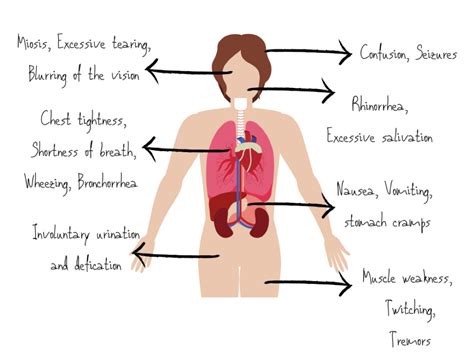 Feeling Nervous? Recognition and Management of Nerve Agent Exposure EMRA