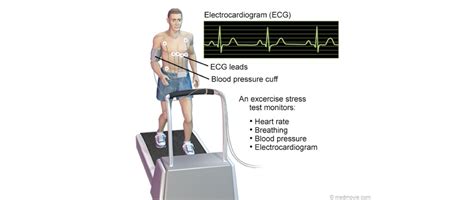 Exercise Stress Echocardiogram - One Heart Cardiology