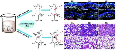 Polydopamine nanoparticles for the treatment of acute inflammation-induced injury - Nanoscale ...