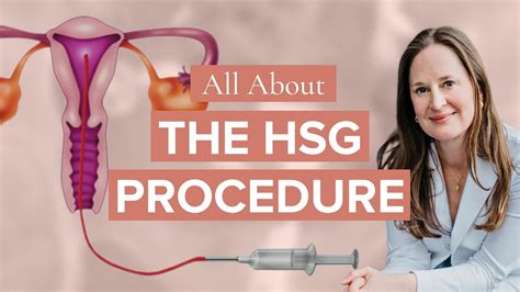 What To Expect At Your HSG | Dr Lora Shahine - YouTube