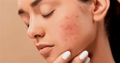 4 Common Skin Problems and How to Treat Them - Mahoney Dermatology