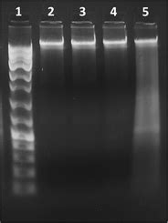 DNA fragmentation assay. Genomic DNA isolated from cells subjected to... | Download Scientific ...