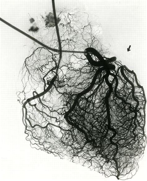 Salient features of the coronary collateral circulation and its clinical relevance