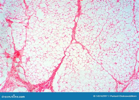 Human Fat Body Tissue Under Microscope View Stock Image - Image of ...