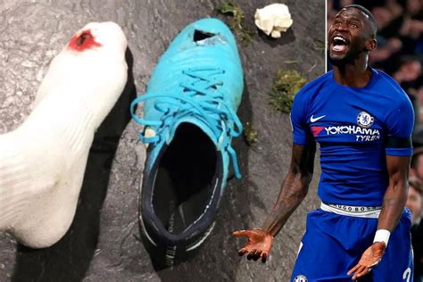 Chelsea 1 Swansea 0: Antonio Rudiger shows of bloody injury after hard ...