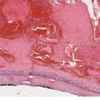 Resected adrenal gland with a smooth surface and adrenal vein. | Download Scientific Diagram