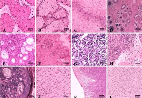 A) Perianal gland adenoma, B) Sebaceous adenoma, C) Sebaceous... | Download Scientific Diagram