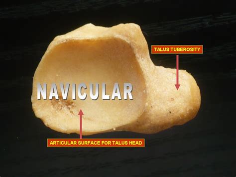 The Navicular Bone