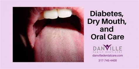 Diabetes and Dry Mouth: Signs and Solutions - Danville Family Dentistry