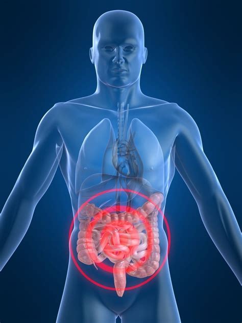 Chronic Inflammation: Chronic Inflammation Of The Colon