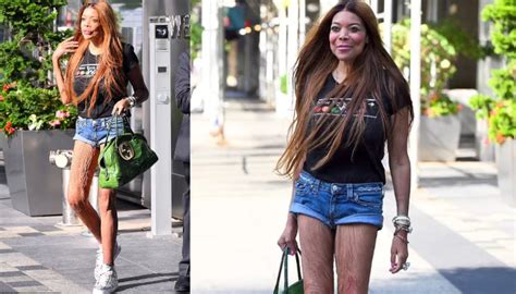 Wendy Williams shocks fans with wrinkly legs