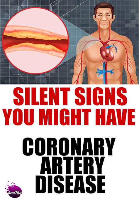 Symptoms Of Clogged Arteries | Arteries, Clogged arteries, Coronary ...