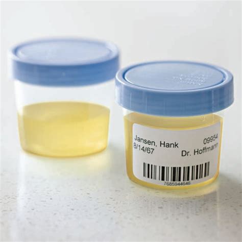 Dymo LabelWriter for printing Urine Sample labels