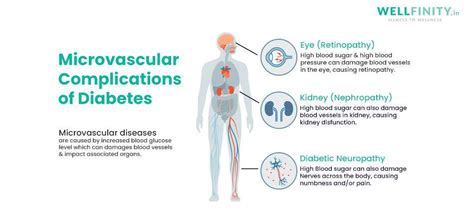 Microvascular Complications of Diabetes - Wellfinity